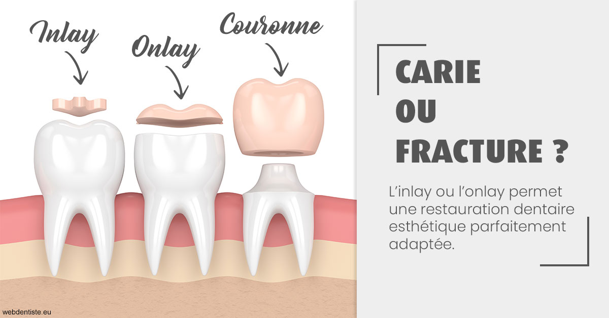 https://www.dr-grenard-orthodontie-gournay.fr/T2 2023 - Carie ou fracture 1