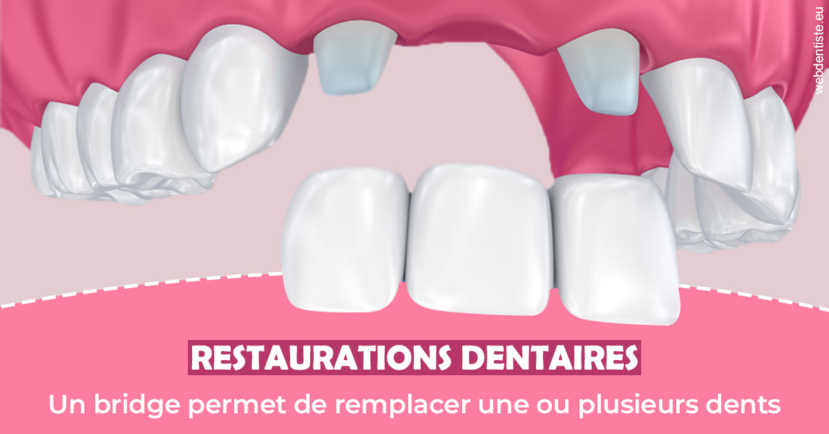 https://www.dr-grenard-orthodontie-gournay.fr/Bridge remplacer dents 2