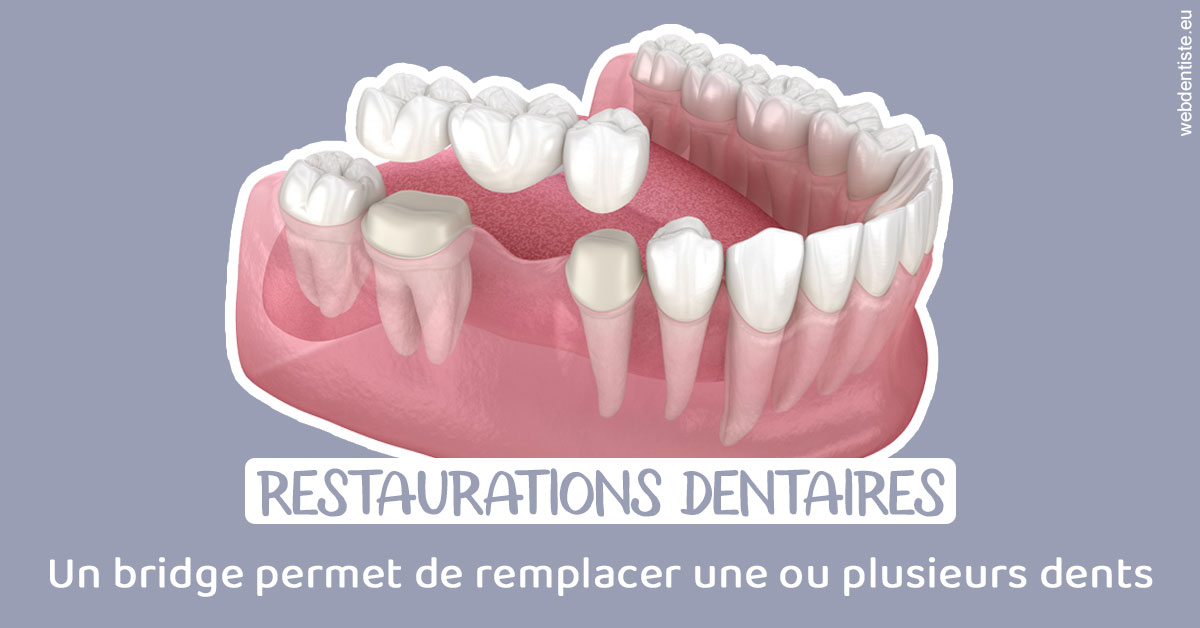 https://www.dr-grenard-orthodontie-gournay.fr/Bridge remplacer dents 1