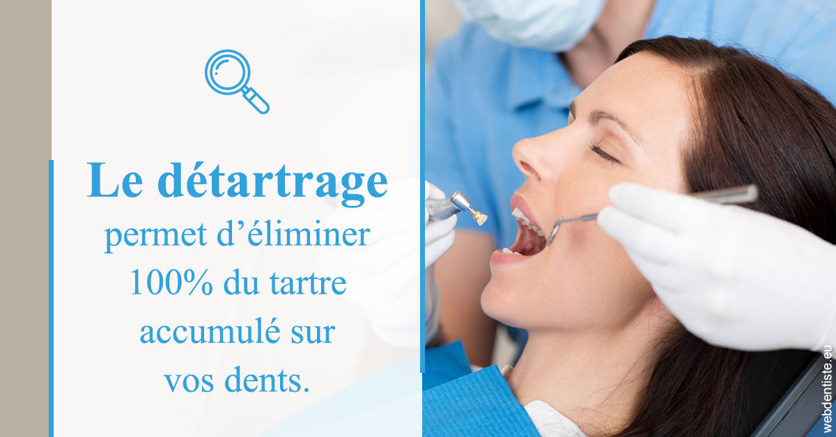 https://www.dr-grenard-orthodontie-gournay.fr/En quoi consiste le détartrage