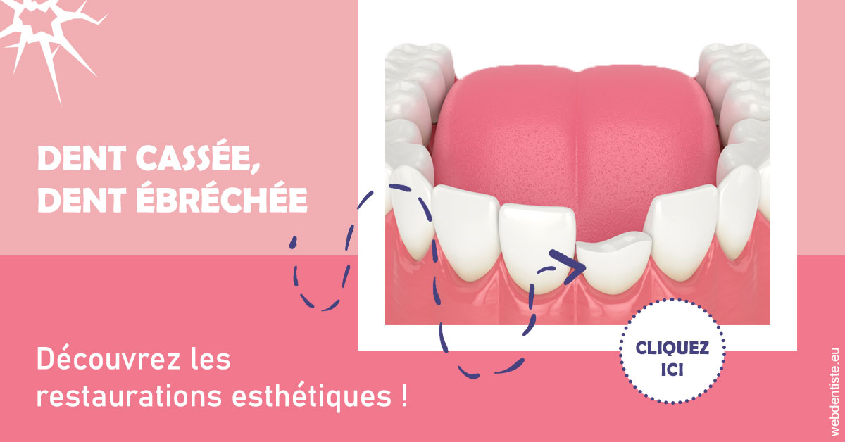 https://www.dr-grenard-orthodontie-gournay.fr/Dent cassée ébréchée 1
