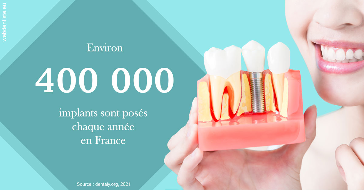 https://www.dr-grenard-orthodontie-gournay.fr/Pose d'implants en France 2