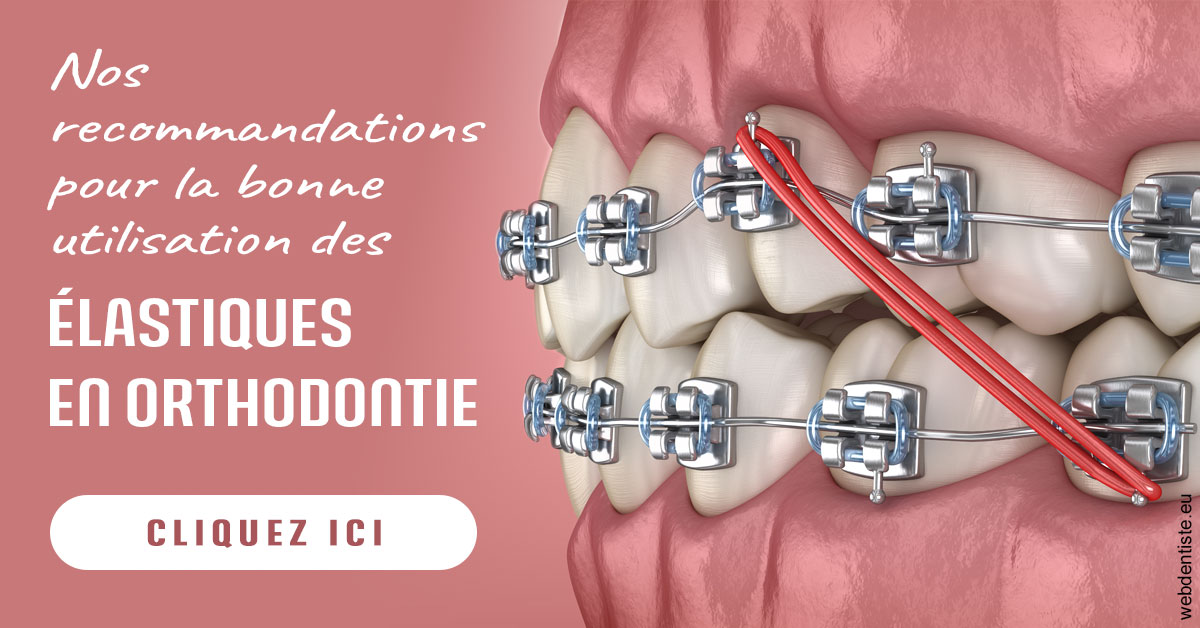 https://www.dr-grenard-orthodontie-gournay.fr/Elastiques orthodontie 2